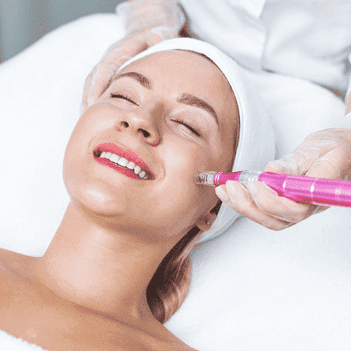 Diodenlaser dauerhafte haarentfernung und Microneedling in Lingenfeld und Germersheim